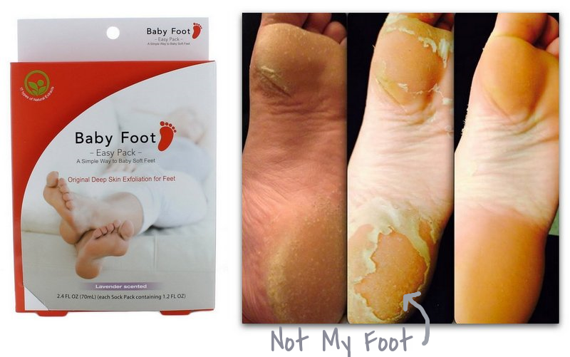 Babyfoot best foot scrub, best foot exfoliator Babyfoot best foot scrub, best foot exfoliator